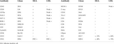 Case report: Composite mantle cell lymphoma and classical Hodgkin lymphoma